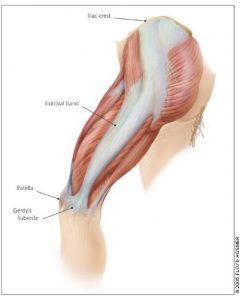 IT Band Syndrome - Professional Physical Therapy & Sports Medicine